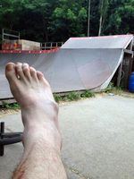 Stephan Götz hat sich im Mellowpark den Mittelfußknochen gebrochen